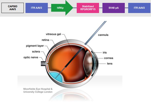 新研究：基因编辑疗法可改善遗传性眼病患者视力