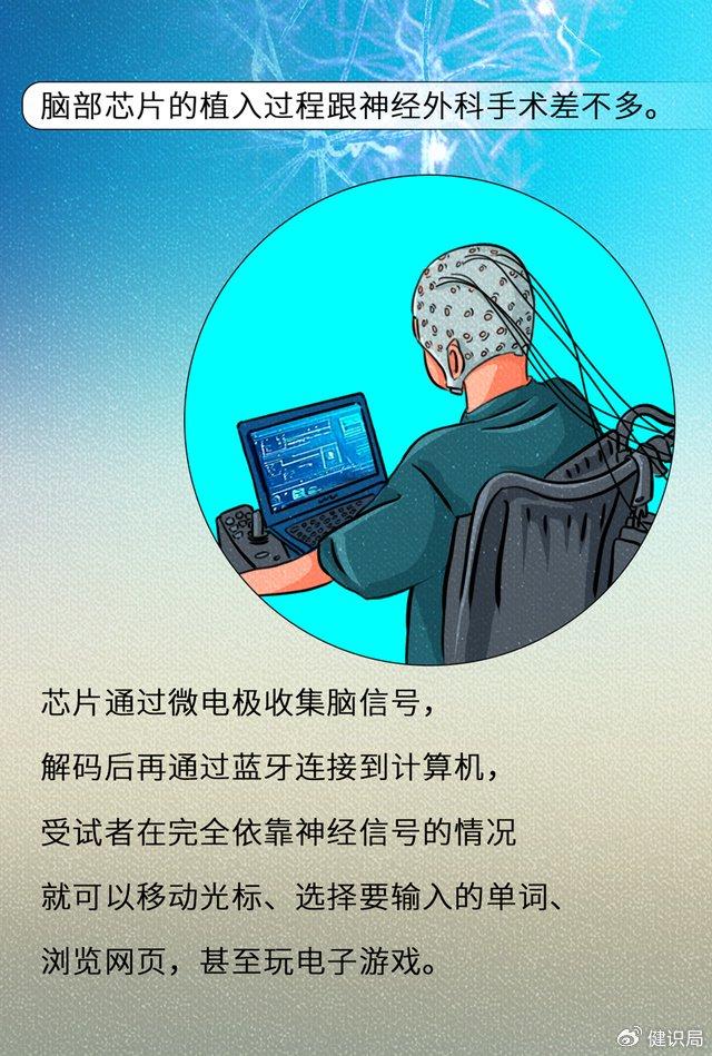 研究人员利用脑机接口尝试解码内心独白